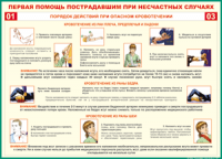 Таблица "Порядок действий при опасном кровотечении" (100х140 сантиметров, винил) - fgospostavki.ru - Грозный